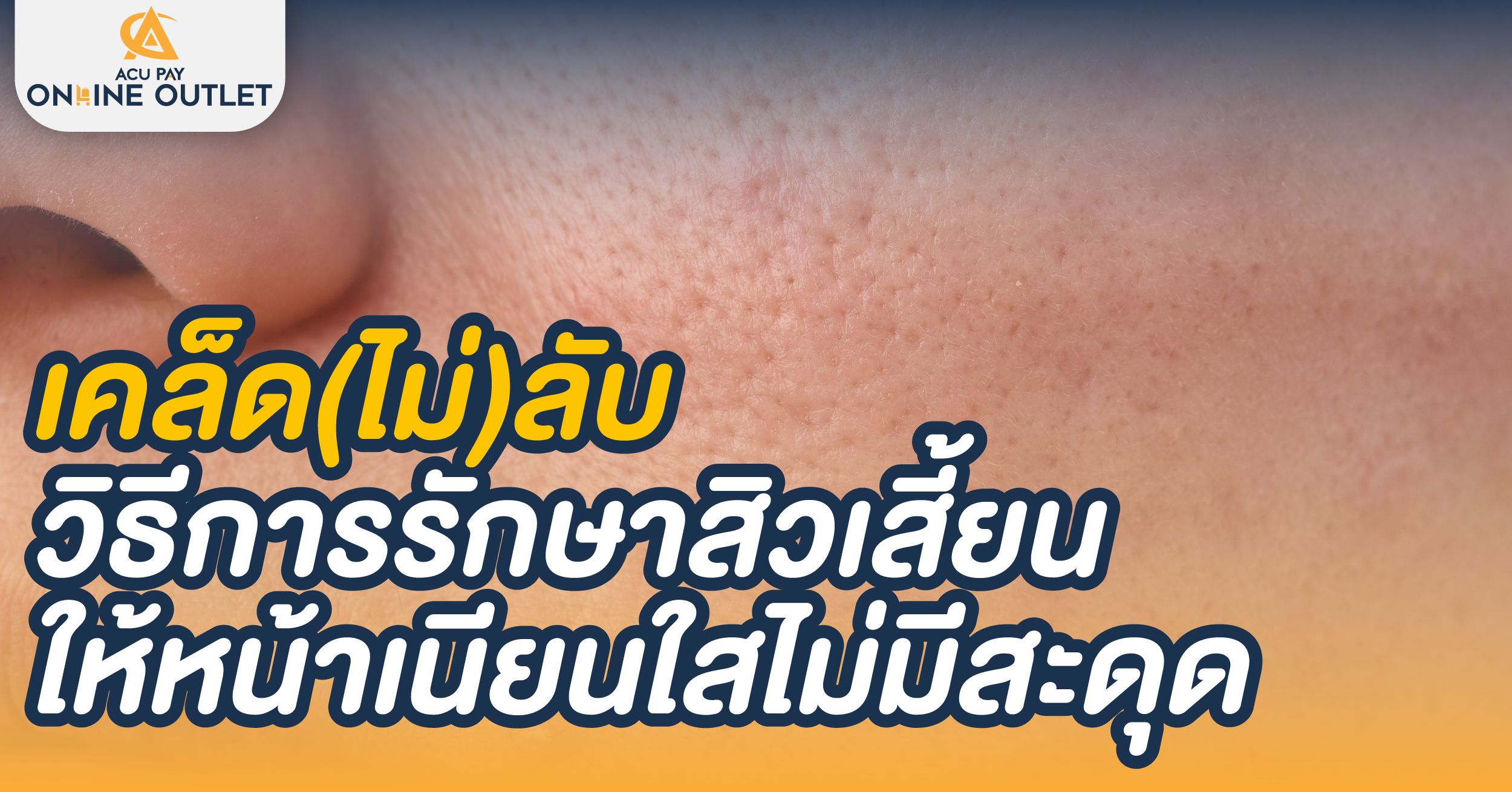 เคล็ดไม่ลับ วิธีรักษาสิวเสี้ยน ให้หน้าเนียบใส